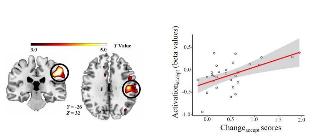 条件下的行为分数与右侧ipl(inferior parietal lobule)显著正相关,即